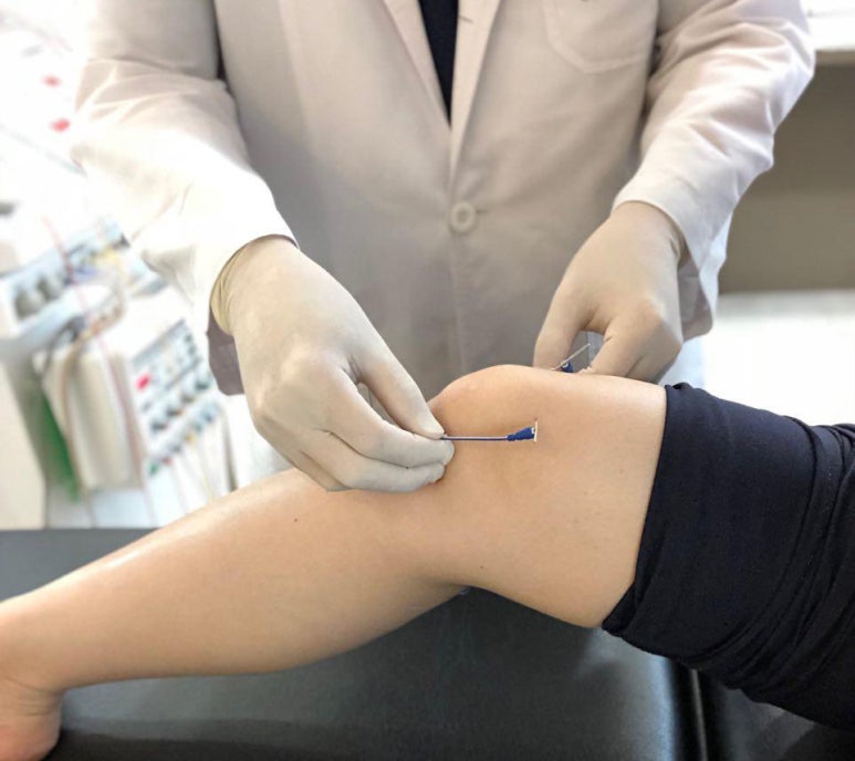 [언론보도] 전기침, '퇴행성 관절염 치료 효과' MRI로 입증... 국제 학술지에 실려
