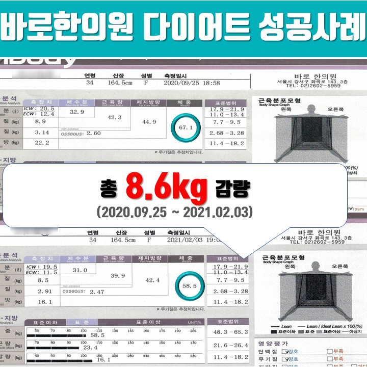 30대 여성 -8.6kg 감량, 약 3개월간 한약다이어트 [화곡역 다이어트 한의원]