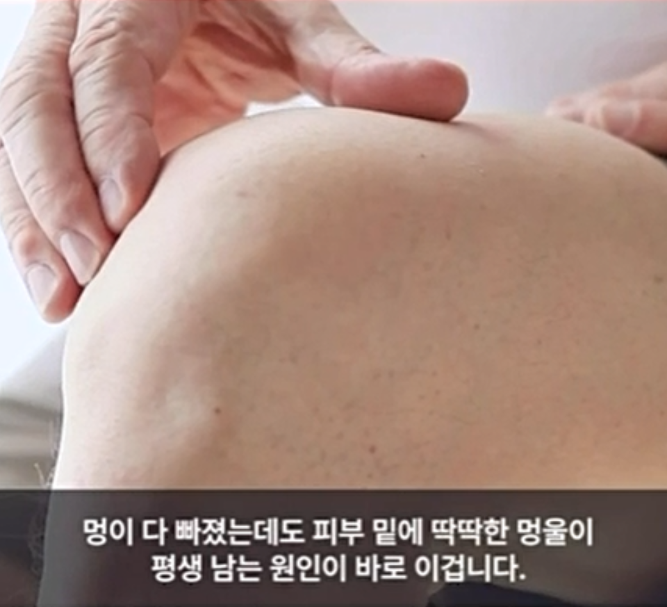 손으로 피부 아래 멍울을 누르는 모습