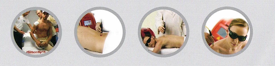 고강도 레이저 치료를 받는 다양한 환자들의 모습이 담긴 네 개의 원형 사진