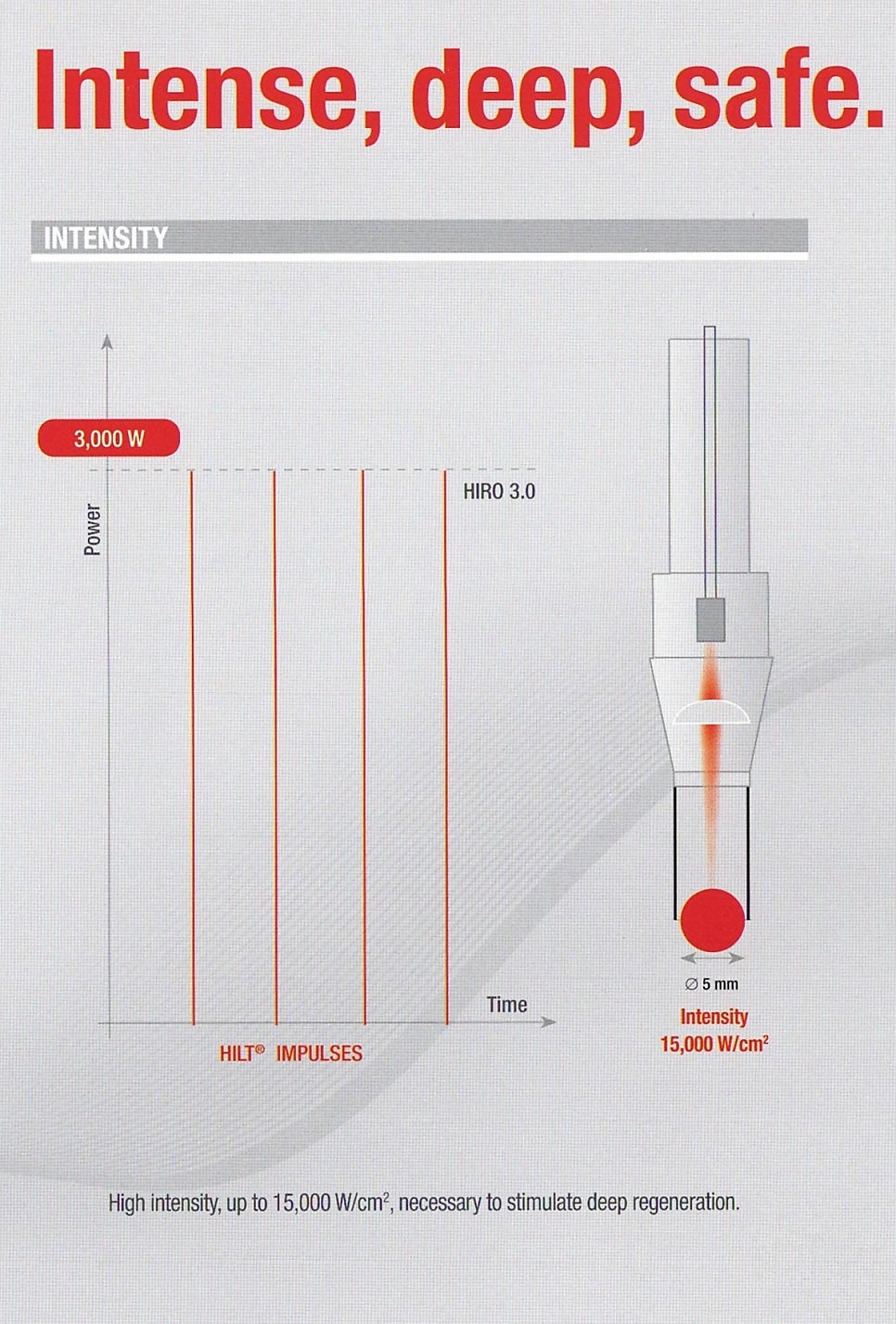 HILT 임펄스와 HIRO 3.0 레이저의 출력 및 시간 그래프와 5mm 직경, 15,000 W/cm² 강도를 나타내는 레이저 핸드피스 다이어그램.