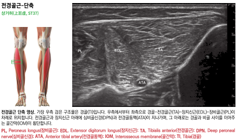 하퇴부 전면 근육의 해부학적 그림과 전경골근, 장지신근, 장비골근, 경골 등의 초음파 영상