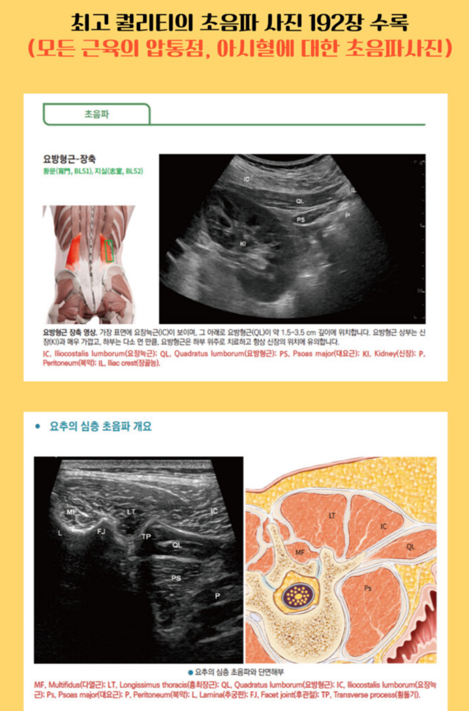 요방형근의 해부학적 그림과 초음파 영상, 요추 심층 근육의 해부학적 단면도와 초음파 영상이 나란히 있는 이미지.