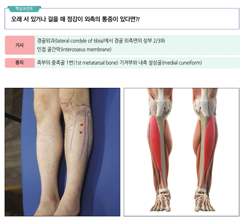 정강이 통증 치료를 위한 다리 해부학적 표시와 정강이 앞쪽 근육 해부도
