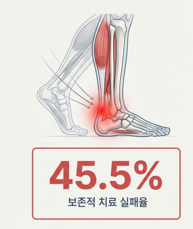 아킬레스건 부위에 통증이 있는 다리 해부도와 45.5%의 보존적 치료 실패율을 나타내는 숫자 박스.