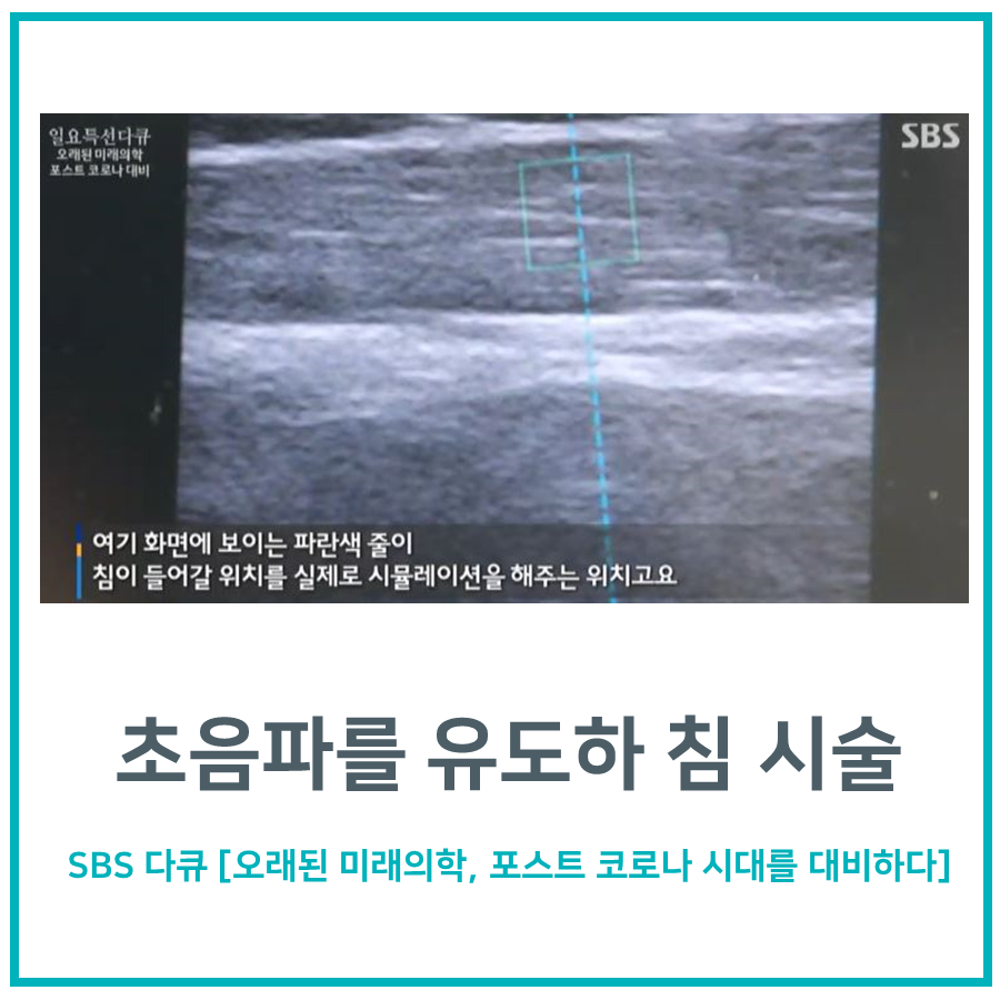 초음파 화면에 침 시술 위치를 시뮬레이션하는 파란색 선이 보이는 모습 — 초음파 유도하 약침 시술 | 서울 바로한의원
