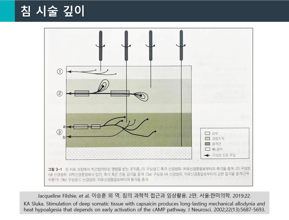 침 시술 깊이에 따른 피부, 결합조직, 골격근 등 여러 조직층과 신경 섬유의 반응을 보여주는 그림.