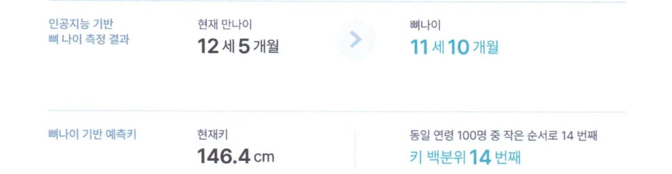 인공지능 기반 뼈 나이 측정 결과와 현재 만 나이, 뼈 나이, 현재 키, 키 백분위가 표시된 화면.