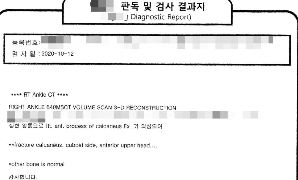 오른쪽 발목 CT 검사 결과지. 2020년 10월 12일 검사일과 발꿈치뼈 골절 소견이 기재되어 있다.