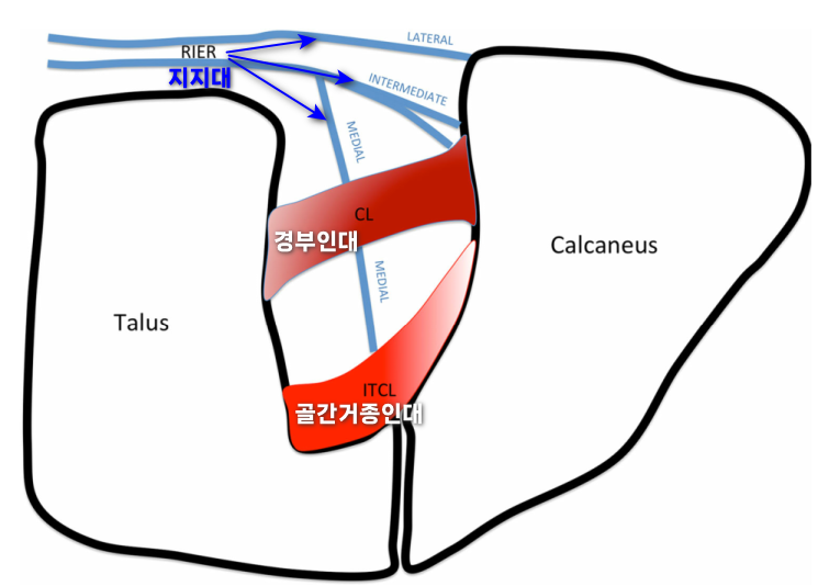 발목의 거골과 종골 사이 족근동 부위 인대 구조를 나타낸 해부학적 그림