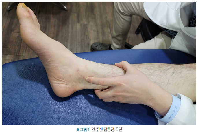 환자의 발목 안쪽 부위를 의사의 손으로 촉진하는 모습