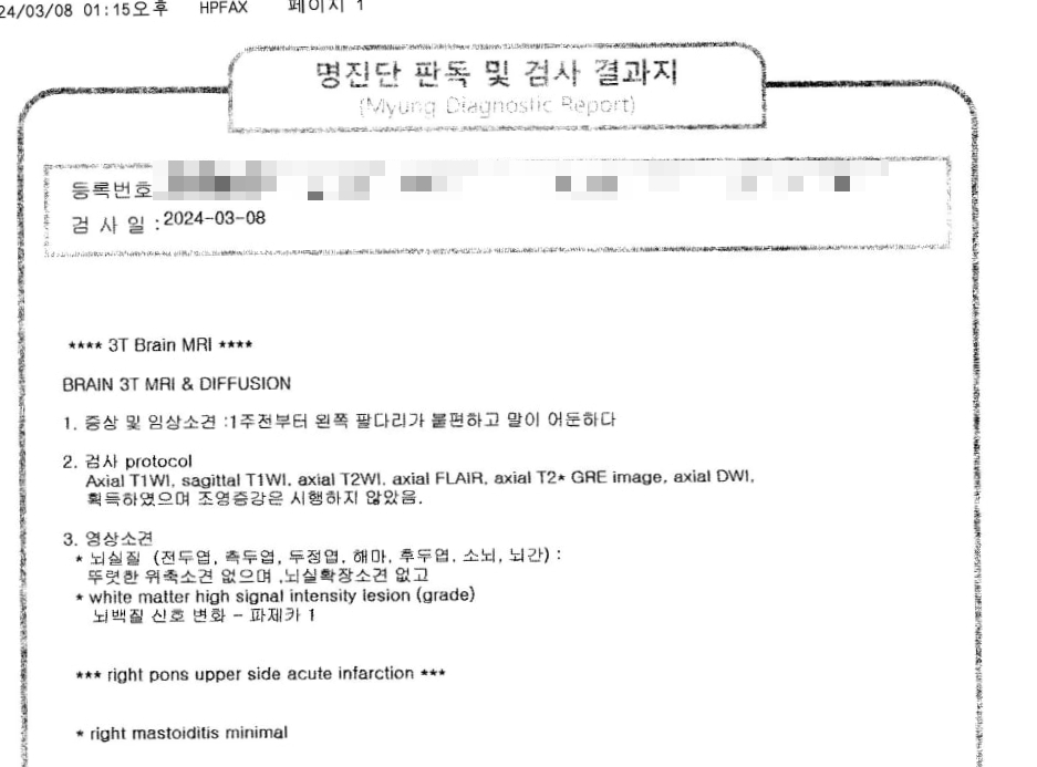 뇌경색 진단과 증상이 기록된 뇌 MRI 검사 결과지
