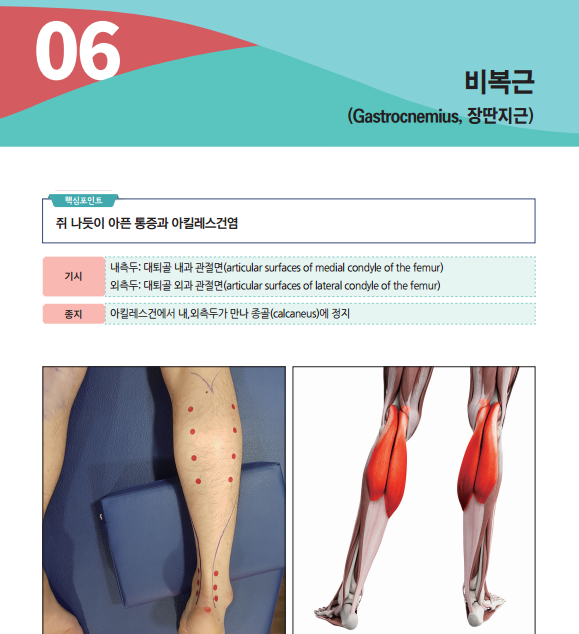 사람 다리에 표시된 종아리 통증점과 비복근 해부학 그림.