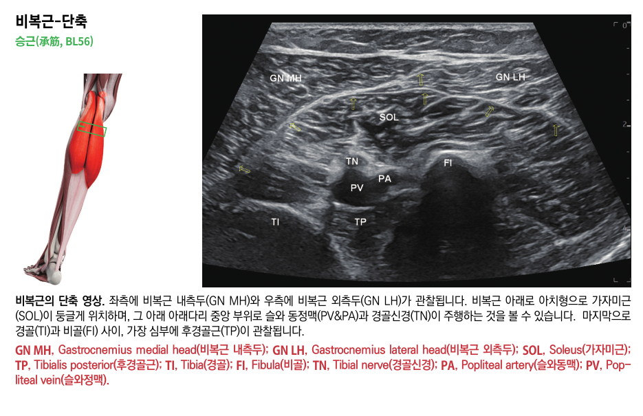 종아리 근육 뭉침 통증, <이것> 있는 곳으로 가야하는 이유