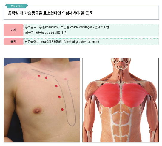 가슴에 해부학적 표시가 된 사람의 상체와 대흉근이 강조된 해부학적 그림
