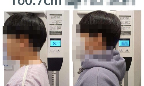 디지털 신장 측정기 옆에 서 있는 두 사람의 측면 모습. 한쪽 측정기 화면에는 160.7이라는 숫자가 보인다.