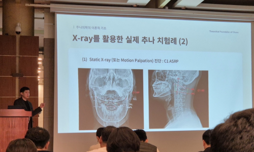 발표자가 청중 앞에서 X-ray 영상이 보이는 슬라이드를 배경으로 추나 치료 사례를 설명하고 있다.