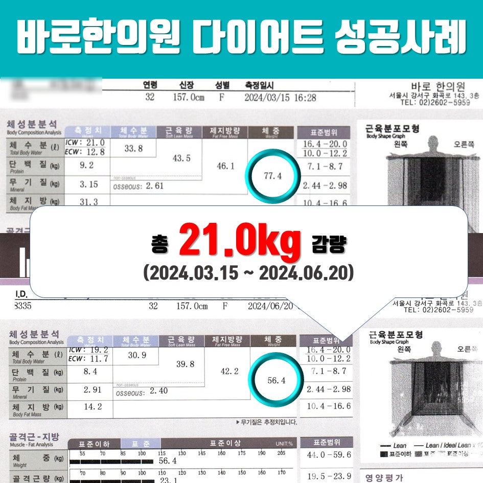 감비환 한약 다이어트 효과있나요? -21kg 감량 사례 [현직 한의사 작성]