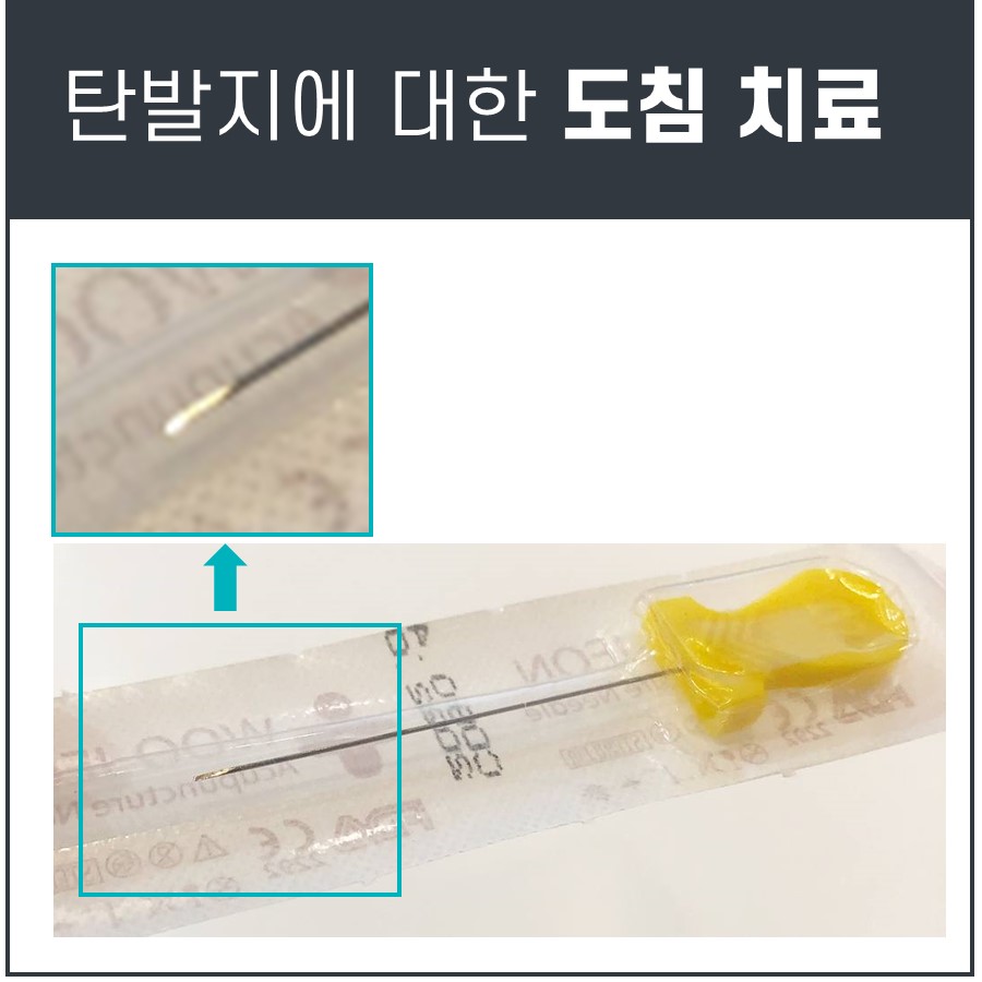 멸균 포장된 도침과 확대된 도침 끝 부분.