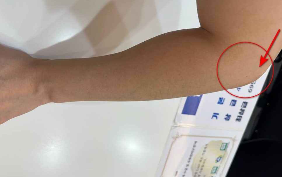 팔꿈치 바깥쪽 통증 테니스엘보우 치료, 수술 전에 <도침> 받아보세요!