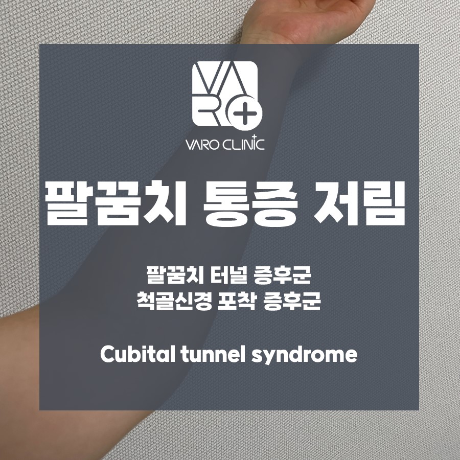 팔꿈치 통증과 저림, 팔꿈치 터널 증후군, 척골신경 포착 증후군에 대한 정보를 담은 안내 이미지