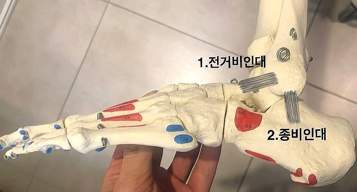발목 모형을 손으로 잡고 있는 모습으로, 전거비인대와 종비인대가 표시되어 있다 — 서울 바로한의원 초음파 약침·도침