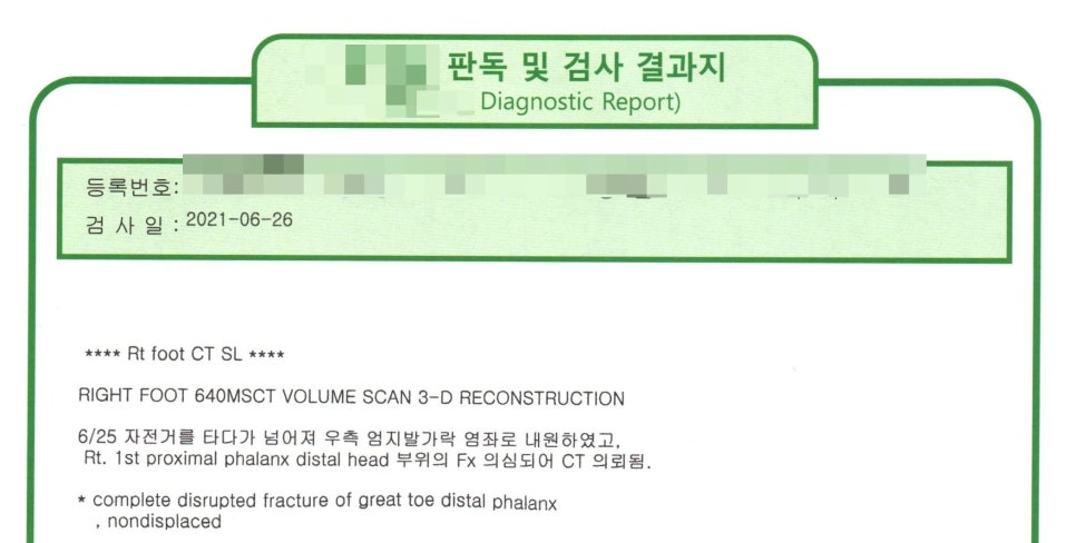 오른쪽 발 CT 검사 결과지. 엄지발가락 원위지골 완전 골절 소견이 적혀 있다.