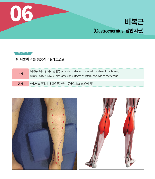 종아리 근육인 비복근의 해부학적 설명과 함께 종아리에 붉은 점으로 표시된 부위 및 비복근 해부학 그림이 있는 이미지