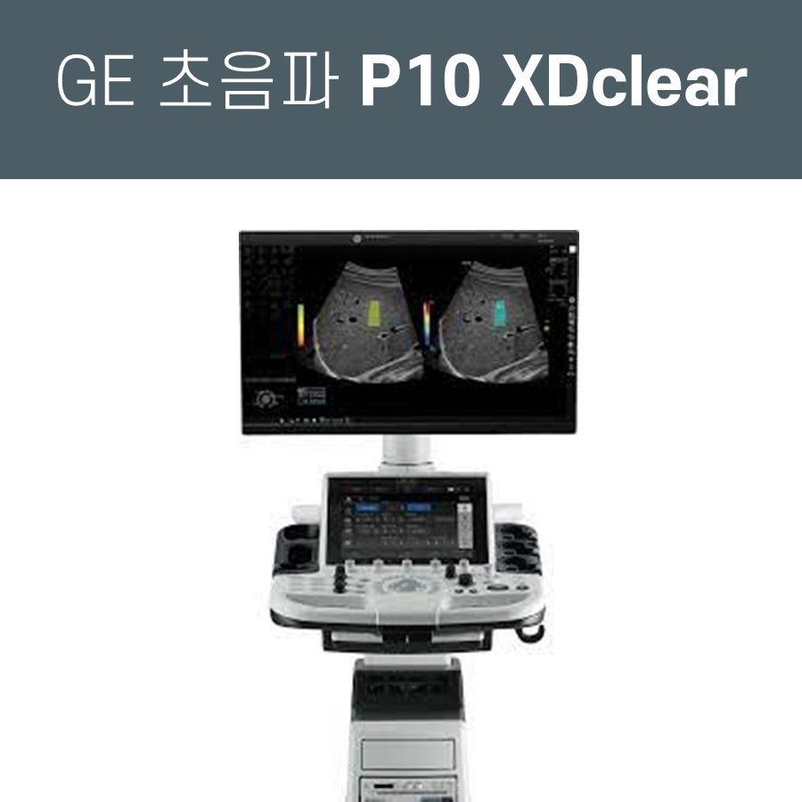 GE 로직 P10 XDclear 초음파 진단기와 화면에 보이는 초음파 영상 — 초음파 정밀 진단 | 서울 바로한의원 초음파 약침·도침·침도