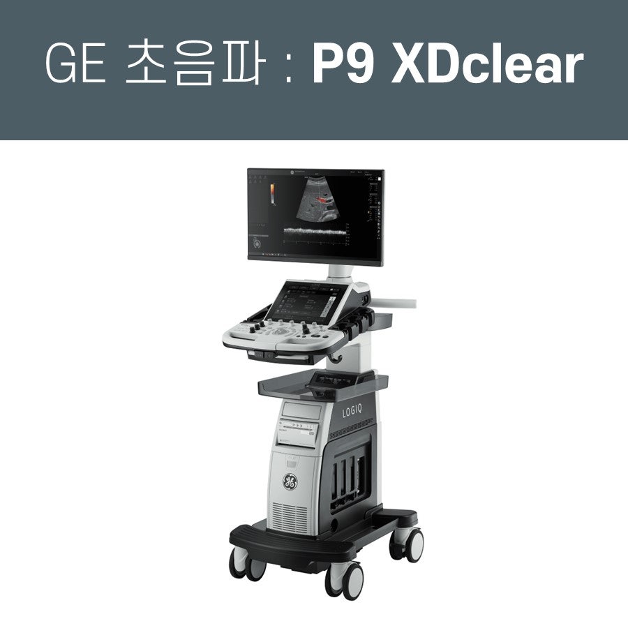 GE LOGIQ P9 XDclear 초음파 진단기가 바퀴 달린 스탠드 위에 놓여 있고, 모니터에는 초음파 영상이 표시되어 있습니다 — 초음파 정밀 진단 | 서울 바로한의원 초음파 약침·도침·침도