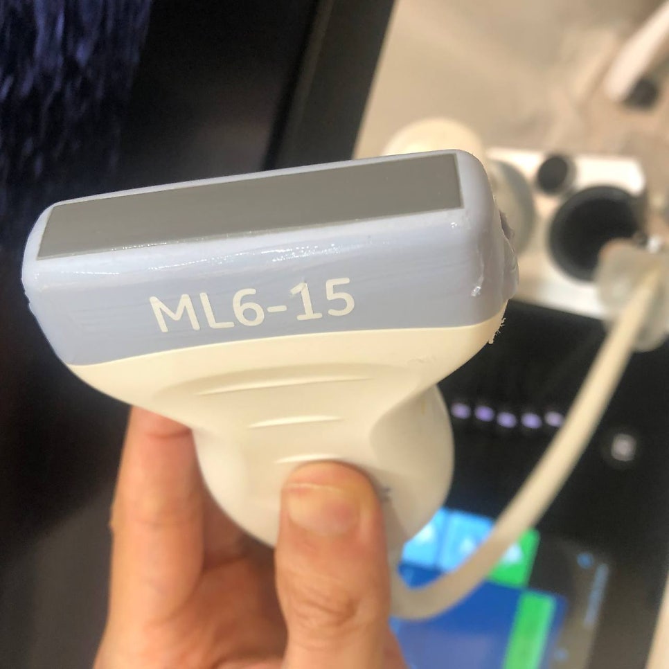 손으로 초음파 프로브를 잡고 있는 모습. 프로브에 'ML6-15'라고 쓰여 있다 — 초음파 유도하 약침 시술 | 서울 바로한의원
