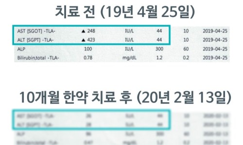 한약 치료 전후의 간 수치(AST, ALT) 검사 결과표.