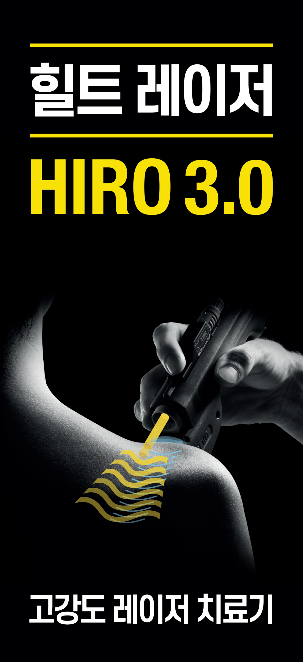 검은 배경에 한 손이 힐트 레이저 치료기 HIRO 3.0을 사용하여 어깨에 레이저를 조사하는 모습