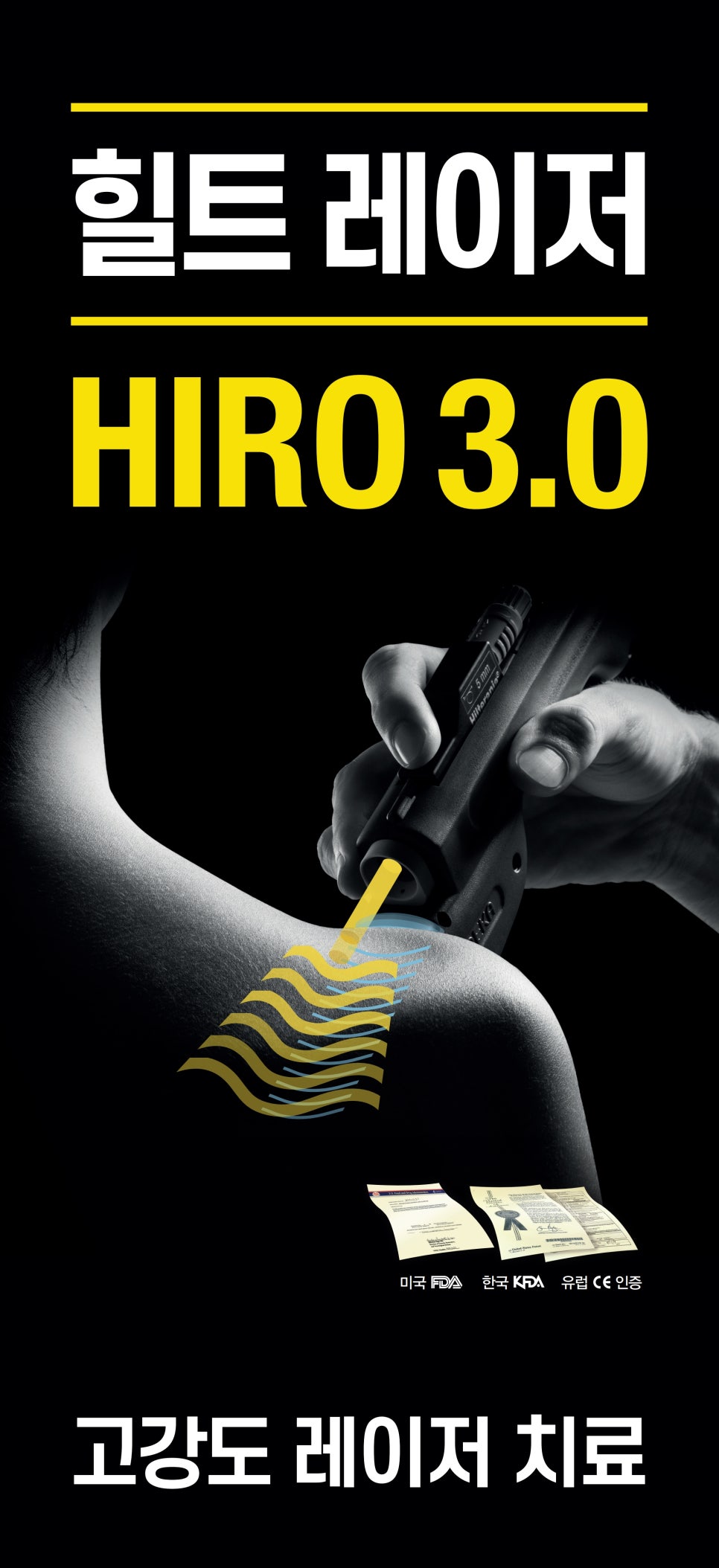 HIRO 3.0 레이저 치료 기기로 사람의 팔에 레이저를 조사하는 모습. 레이저가 피부에 닿는 부분을 물결 모양으로 표현했으며, 하단에 FDA, KFDA, CE 인증 문구가 있다.