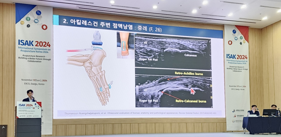 ISAK 2024 국제학술대회에서 연사가 아킬레스건 주변 점액낭염 초음파 이미지와 해부학적 그림이 있는 발표 화면 앞에서 이야기하고 있다.