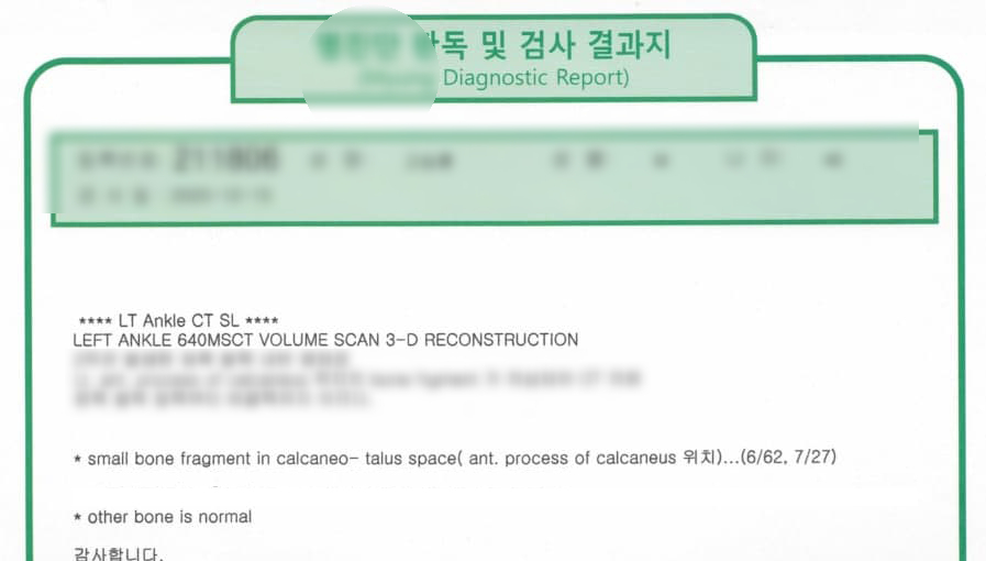 왼쪽 발목 CT 스캔 진단 보고서로, 작은 뼈 조각이 발견되었다는 내용이 포함되어 있다 — 서울 바로한의원 초음파 약침·도침
