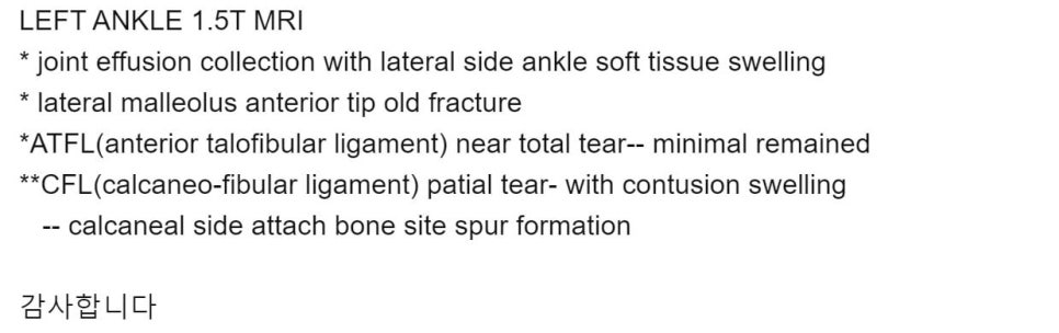 왼쪽 발목 1.5T MRI 검사 결과 보고서로, 관절 삼출액, 연부조직 부종, 외측 복사뼈 골절, 전거비인대 및 종비인대 파열 소견이 기록되어 있다.