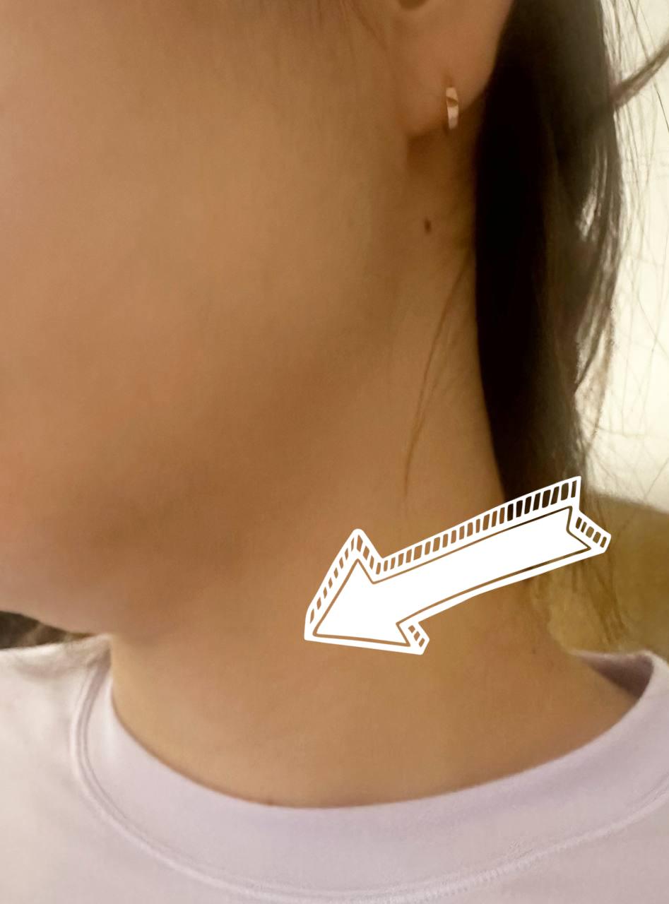 한 사람의 목과 어깨 부위를 측면에서 촬영한 사진으로, 흰색 화살표가 목 옆 부분을 가리키고 있습니다.