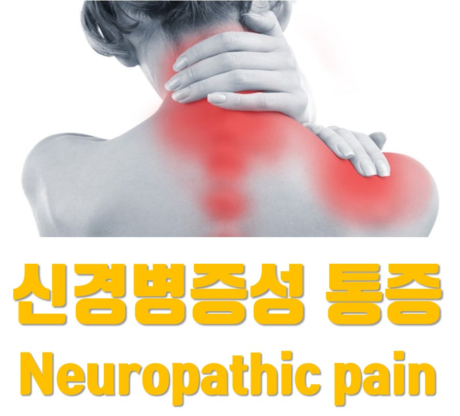 목과 어깨, 등 부위에 붉은색으로 통증 부위가 표시된 사람의 뒷모습 이미지와 '신경병증성 통증 Neuropathic pain'이라는 글자 — 서울 바로한의원 초음파 약침·도침