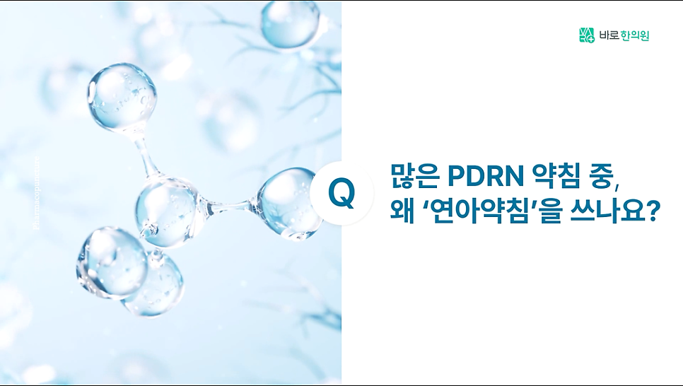 푸른 배경에 투명한 구슬 모양의 분자 구조와 '많은 PDRN 약침 중, 왜 연아약침을 쓰나요?'라는 질문 텍스트가 함께 있는 이미지.