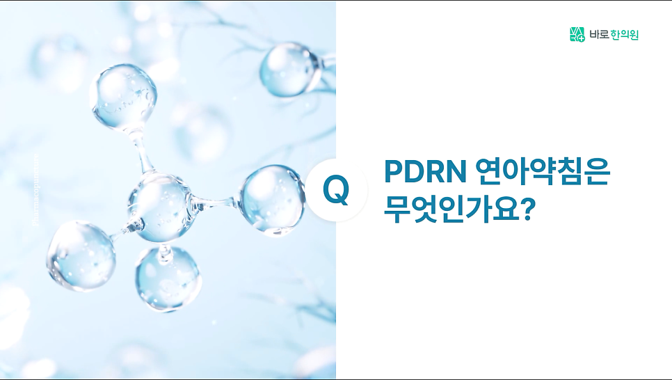 밝은 파란색 배경에 투명한 구형 분자 구조가 있고, 오른쪽에 'PDRN 연아약침은 무엇인가요?'라는 질문이 적혀 있습니다.
