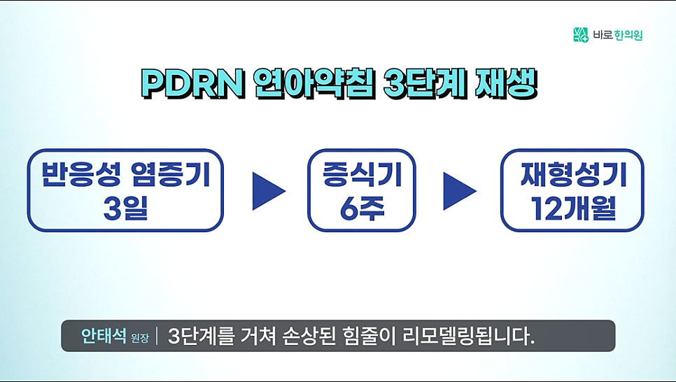 PDRN 연아약침의 3단계 재생 과정을 설명하는 다이어그램으로, 반응성 염증기, 증식기, 재형성기 각 단계의 기간이 표시되어 있다.