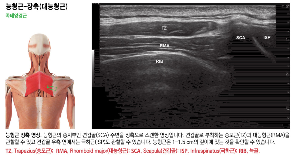 능형근의 해부학적 위치를 보여주는 인체 그림과 능형근, 승모근, 견갑골, 극하근, 늑골이 표시된 장축 초음파 영상.
