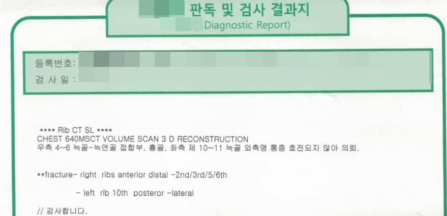 갈비뼈 골절 진단이 기록된 CT 검사 결과지