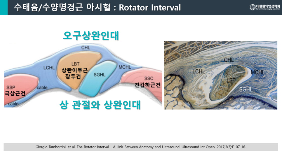 어깨 회전근개 간격의 해부학적 구조를 보여주는 도식과 조직 사진.