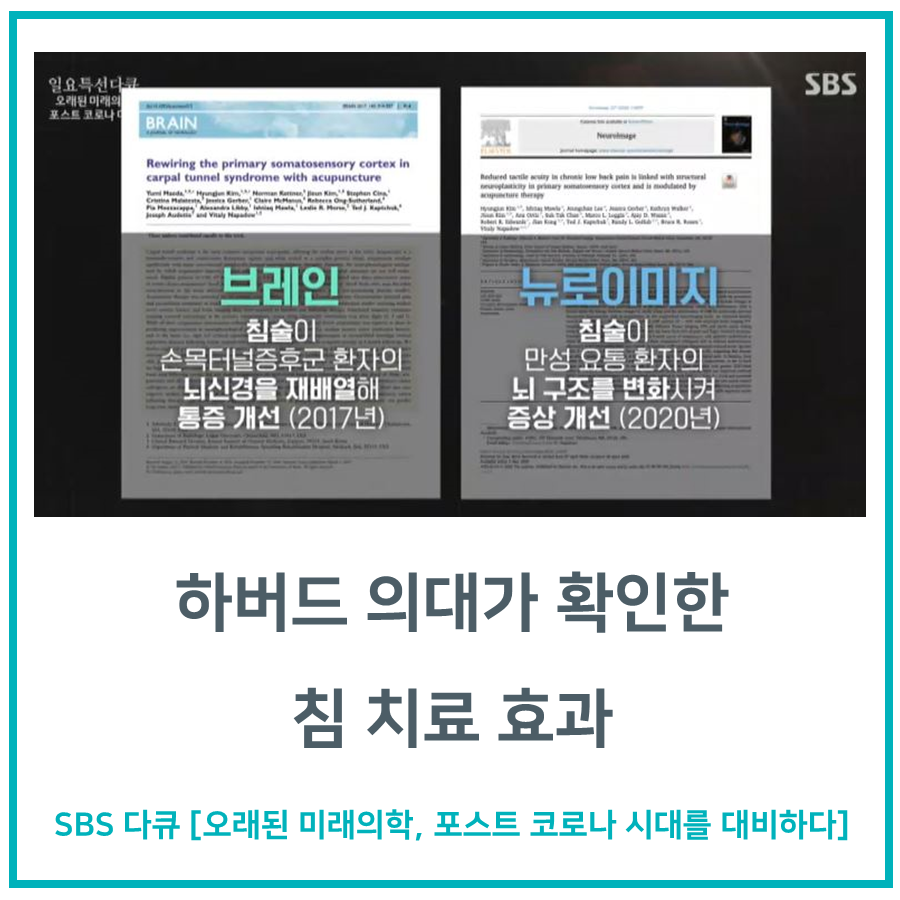 SBS 다큐멘터리 화면에 침 치료 효과에 대한 하버드 의대 연구 논문 두 편의 제목과 요약이 제시되어 있다 — 초음파 약침·도침 임상 논문 | 서울 바로한의원