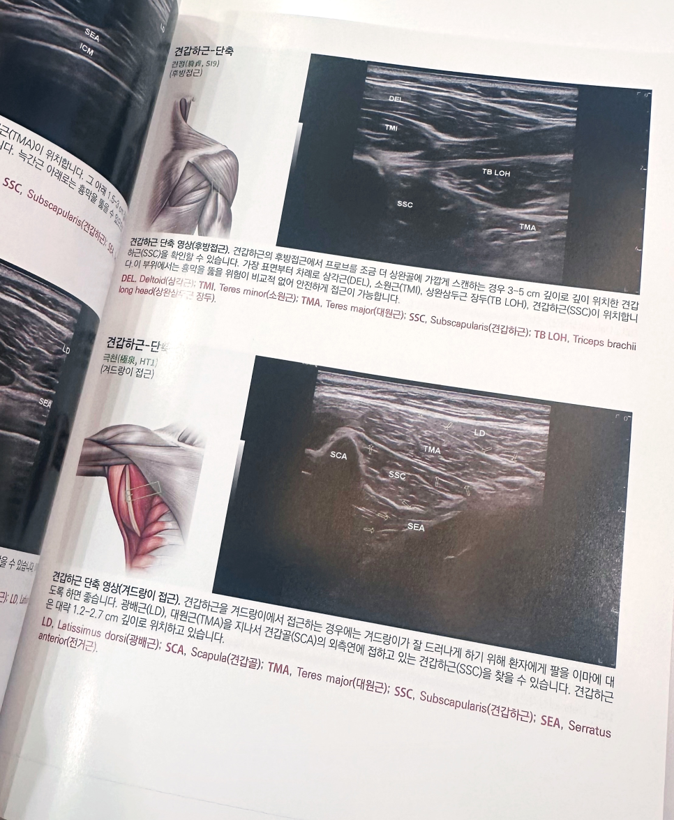 견갑하근의 후방 및 겨드랑이 접근법을 보여주는 해부학 그림과 초음파 영상이 있는 의학 서적 페이지.