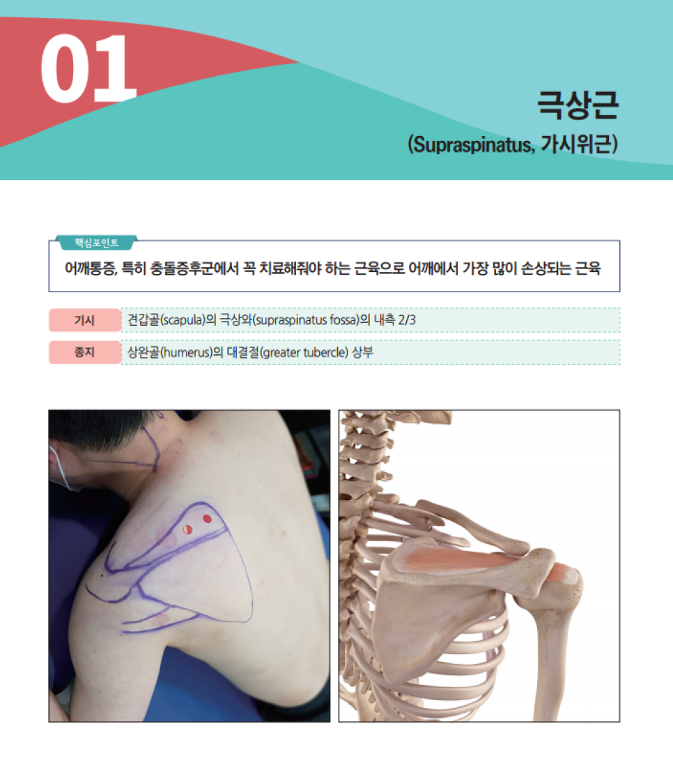 극상근의 해부학적 위치와 기시, 종지 정보가 있는 이미지로, 실제 어깨에 표시된 극상근 위치와 뼈대 모형에 표시된 극상근을 보여줍니다.
