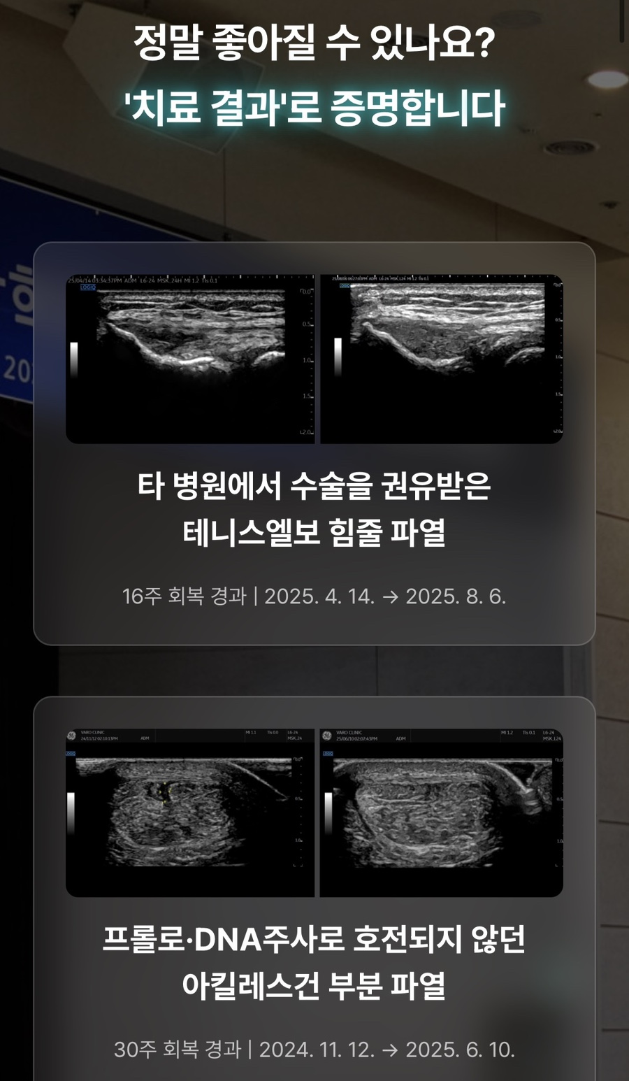 테니스엘보 힘줄 파열과 아킬레스건 부분 파열의 치료 전후를 보여주는 두 쌍의 초음파 이미지와 회복 경과 정보.
