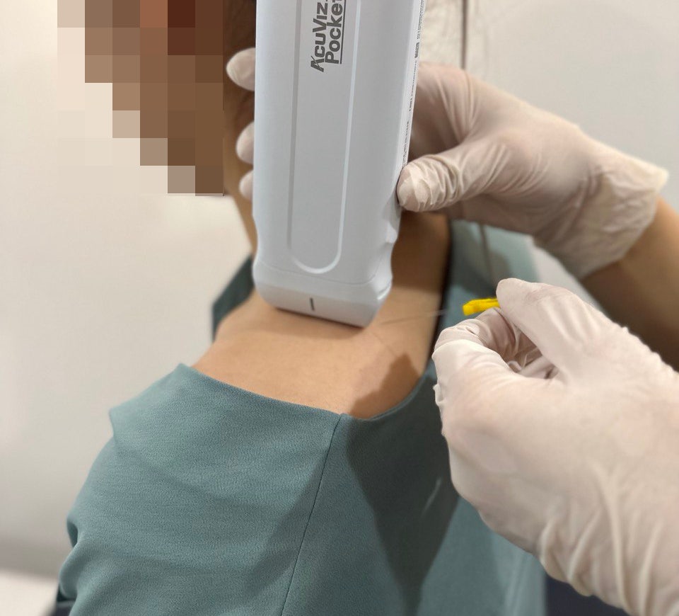 환자의 목과 어깨 부위에 초음파 기기를 대고 침 시술을 준비하는 모습